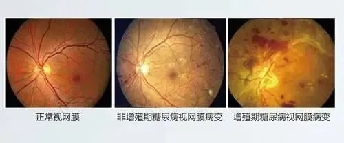 微信图片_20220214104555.jpg 微信图片_20220214104555.jpg
