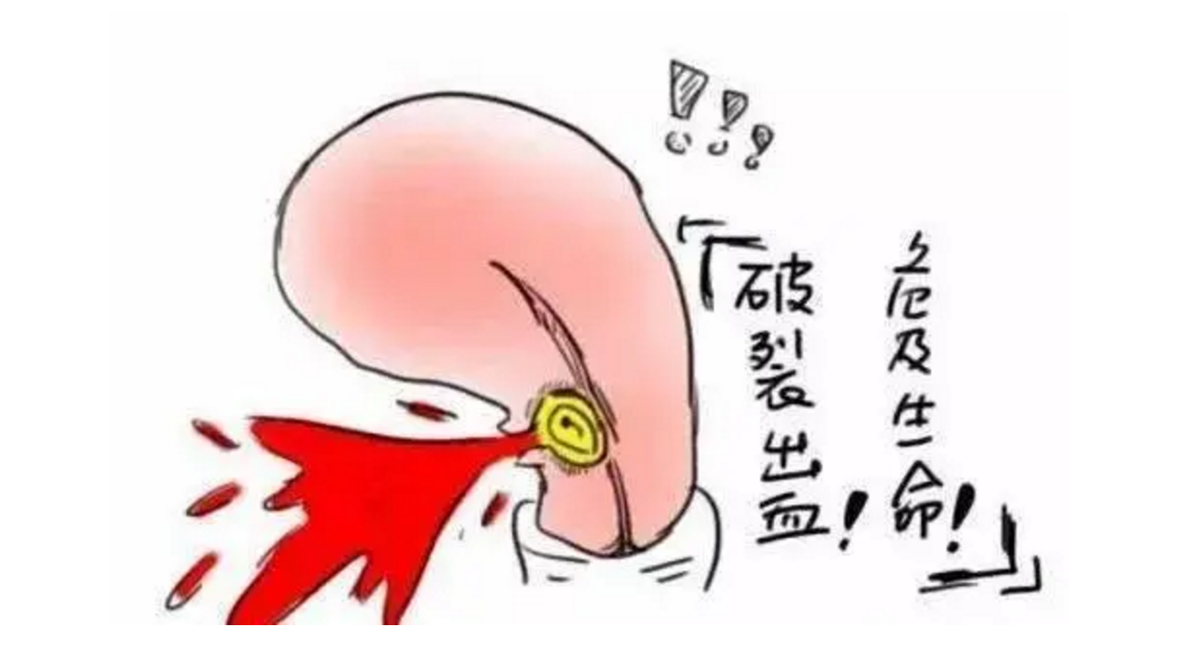 e42ea9bcad5bb2d1e994bde0c4c777a.png