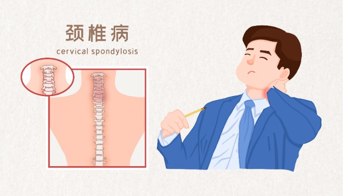摄图网_401799963_颈椎病医疗插画(非企业商用).jpg 摄图网_401799963_颈椎病医疗插画(非企业商用).jpg