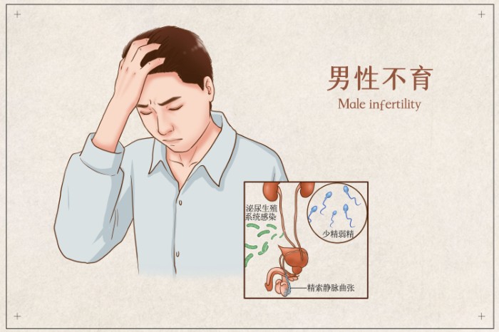 摄图网_401863473_男性不育医疗插画(非企业商用).jpg