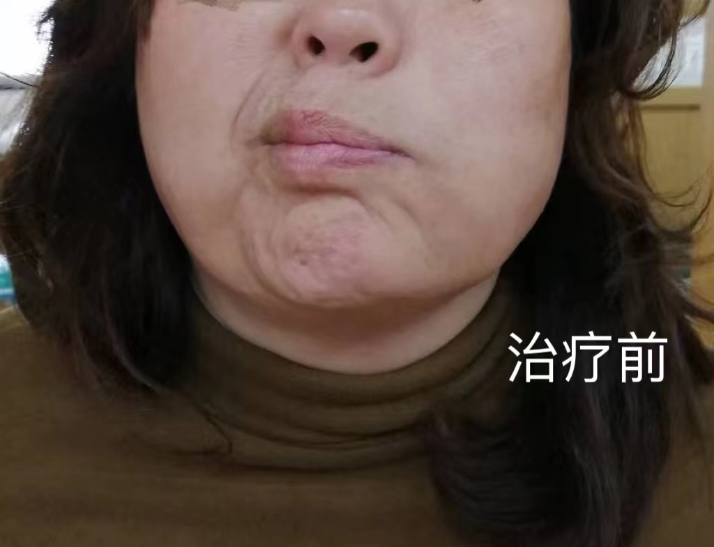 图片 1.png 图片 1.png
