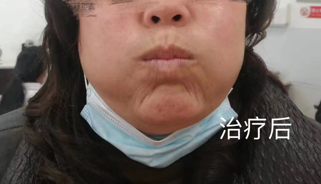 图片 2.png 图片 2.png
